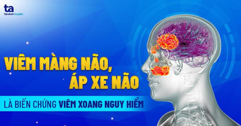 Hinh anh minh hoa bien chung viem xoang mui anh huong den mat, gay sung phu vung quanh mat